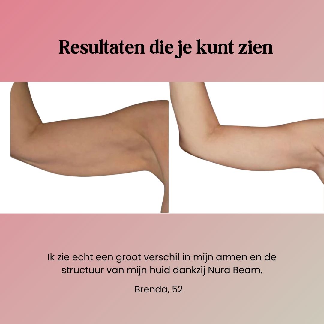 NuraSculpt Arm Band